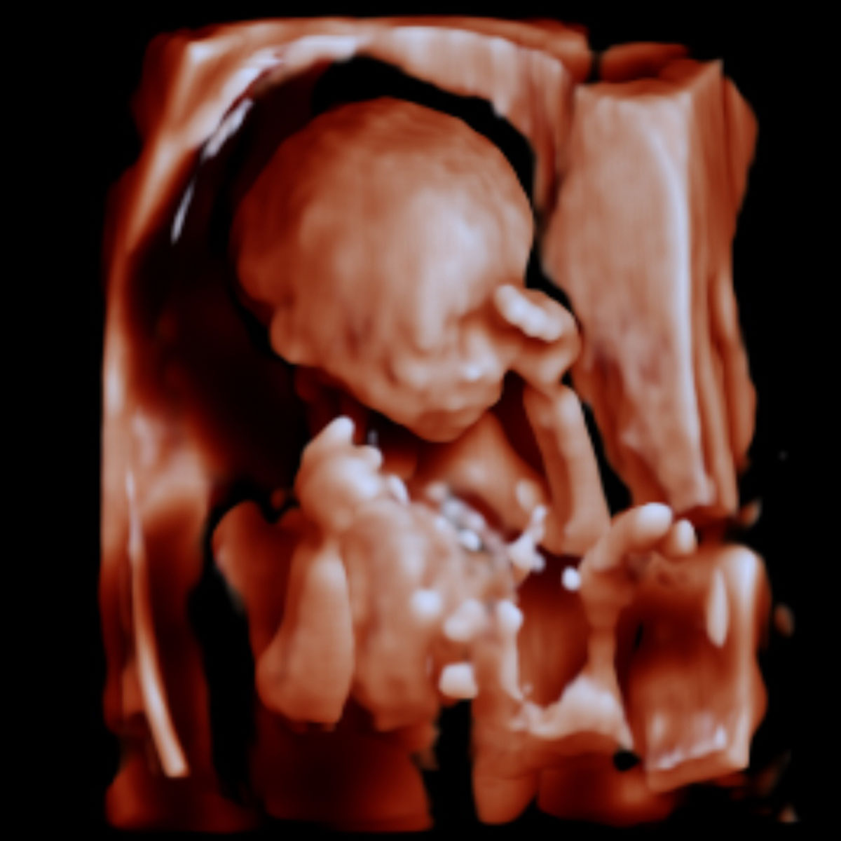 4D/HD Ultrasound Pregnancy Scan Fatima Gani