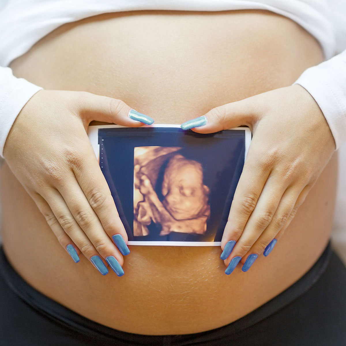 pregnancy scan contact us